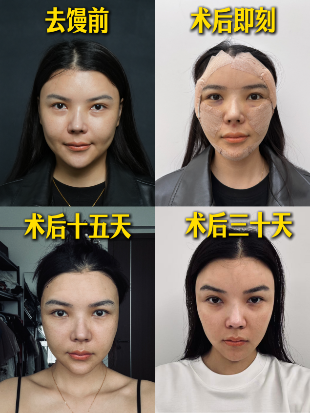 贺女士的案例