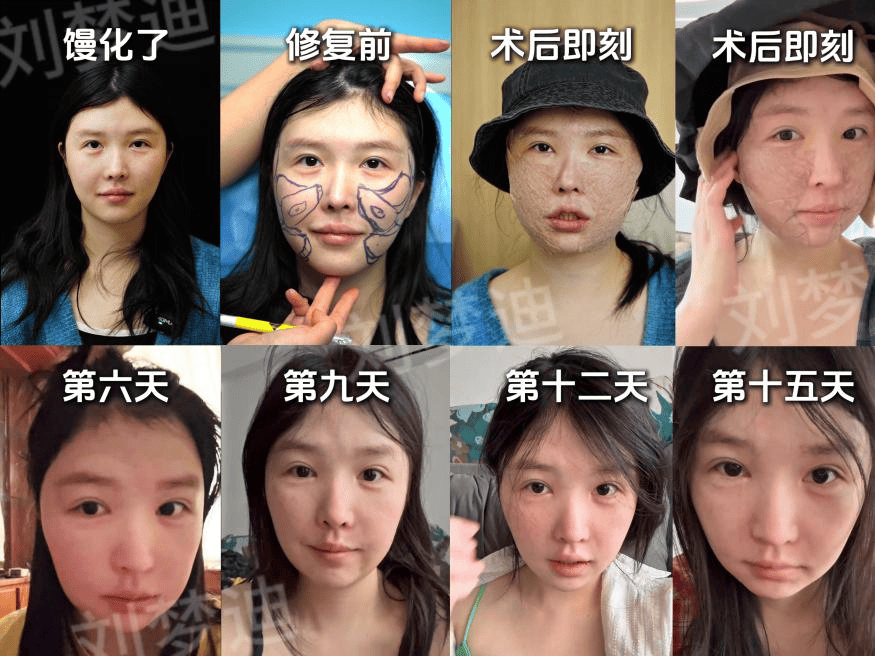 苏女士的案例