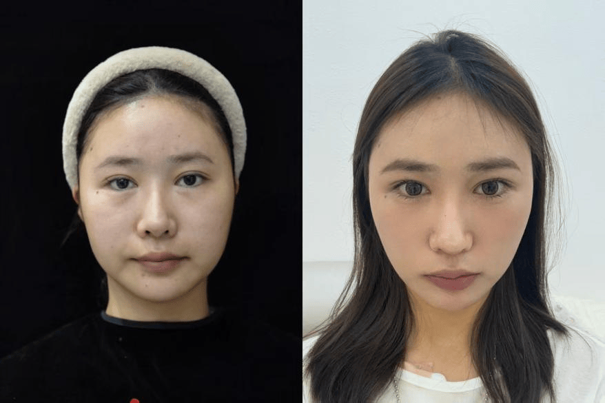 彭女士的案例