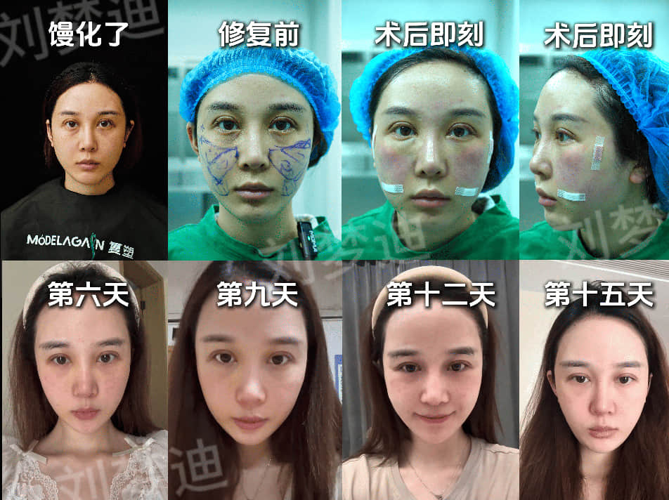 邓女士的案例