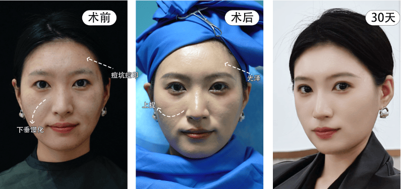 李女士的案例